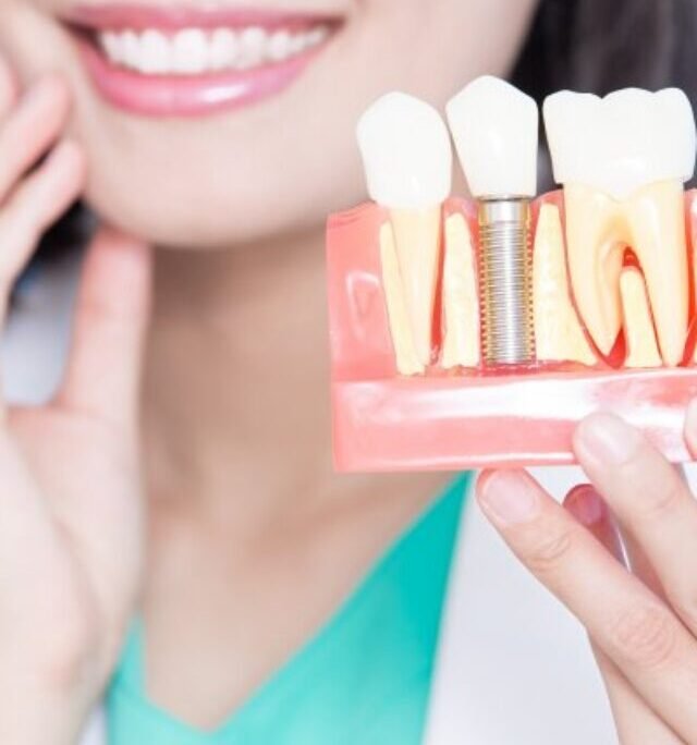 Dental Implants