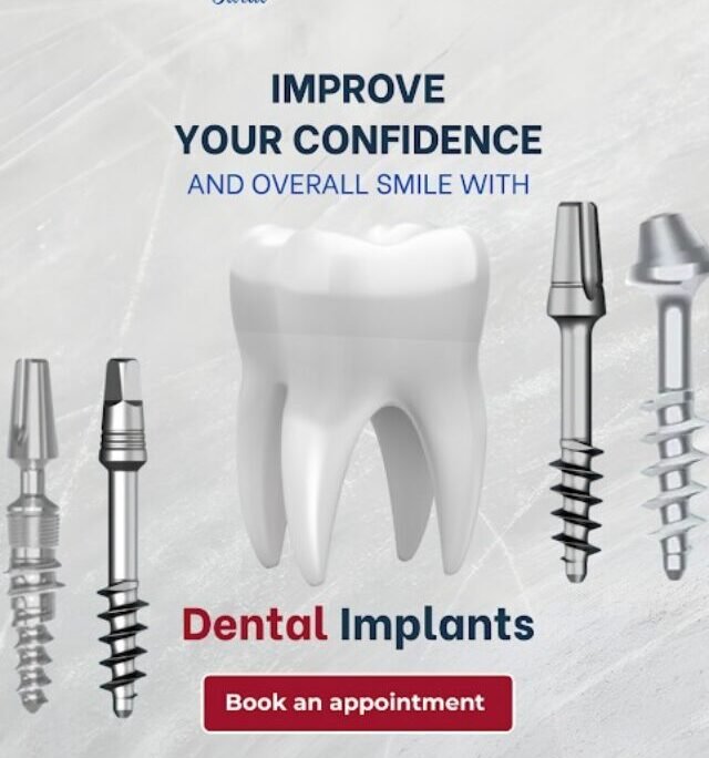Improve smile confidence with dental implants, perfect teeth restoration, cosmetic dentistry, advanced smile makeover, professional dental care
