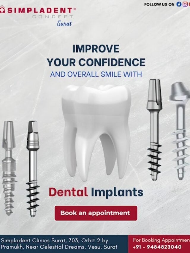 Improve Your Confidence and Overall Smile with Advanced Dental Implant Solutions